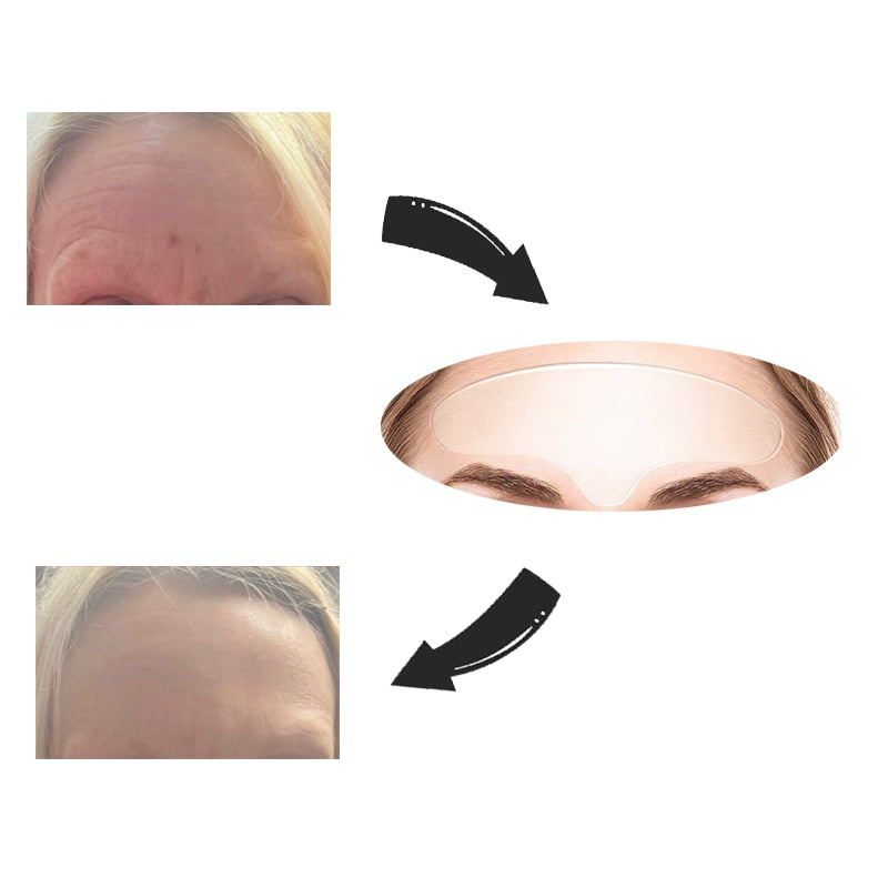 Nuevo botox Libre de Arrugas y Líneas de Expresión 18 Piezas