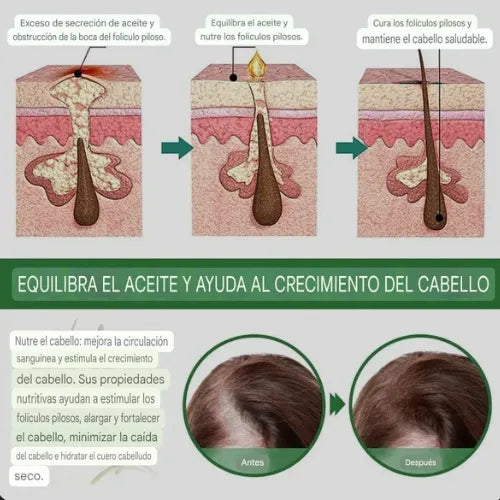 Aceite de Romero | ¡Despídete de la caída del cabello!