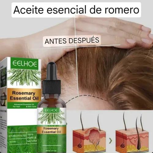 Aceite de Romero | ¡Despídete de la caída del cabello!