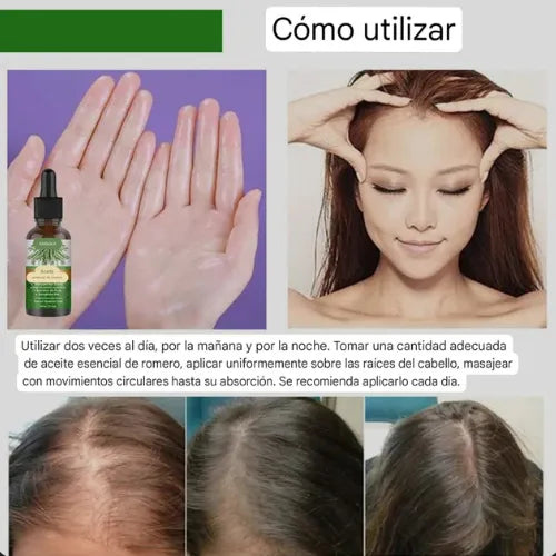Aceite de Romero | ¡Despídete de la caída del cabello!